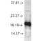 Superoxide Dismutase 1 antibody, 13001, QED Bioscience, Western Blot image 