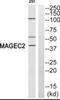 MAGE Family Member C2 antibody, PA5-39603, Invitrogen Antibodies, Western Blot image 
