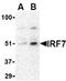 CD5 Molecule Like antibody, orb108956, Biorbyt, Western Blot image 