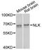 Nemo Like Kinase antibody, MBS127638, MyBioSource, Western Blot image 