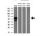 Solute Carrier Family 18 Member A2 antibody, NBP1-47977, Novus Biologicals, Western Blot image 