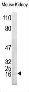 C-C Motif Chemokine Ligand 2 antibody, 251472, Abbiotec, Immunohistochemistry paraffin image 