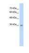 TraB Domain Containing antibody, NBP1-70734, Novus Biologicals, Western Blot image 