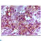 FOXP3 antibody, LS-C812607, Lifespan Biosciences, Immunohistochemistry paraffin image 