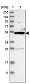 Zinc finger and SCAN domain-containing protein 21 antibody, PA5-54834, Invitrogen Antibodies, Western Blot image 