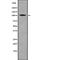 Receptor Tyrosine Kinase Like Orphan Receptor 2 antibody, abx218339, Abbexa, Western Blot image 