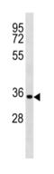 Cyclin D2 antibody, abx034758, Abbexa, Western Blot image 