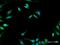 6-Phosphofructo-2-Kinase/Fructose-2,6-Biphosphatase 1 antibody, H00005207-D01P, Novus Biologicals, Immunofluorescence image 