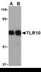 Toll Like Receptor 10 antibody, AHP935, Bio-Rad (formerly AbD Serotec) , Western Blot image 