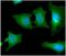 SBDS Ribosome Maturation Factor antibody, NBP2-22594, Novus Biologicals, Immunocytochemistry image 