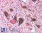 Ubiquitin C-Terminal Hydrolase L1 antibody, LS-C142133, Lifespan Biosciences, Immunohistochemistry paraffin image 