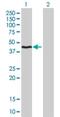 Hydroxymethylbilane Synthase antibody, H00003145-M01, Novus Biologicals, Western Blot image 