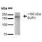 ATP Binding Cassette Subfamily C Member 8 antibody, MA5-27660, Invitrogen Antibodies, Western Blot image 