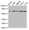 Eukaryotic Translation Initiation Factor 2 Alpha Kinase 1 antibody, CSB-PA007510LA01HU, Cusabio, Western Blot image 