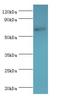 Mesothelin antibody, LS-C376194, Lifespan Biosciences, Western Blot image 