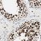 Sirtuin 1 antibody, HPA006295, Atlas Antibodies, Immunohistochemistry paraffin image 