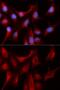 Proteasome Subunit Beta 4 antibody, GTX33431, GeneTex, Immunofluorescence image 