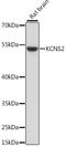 Potassium Voltage-Gated Channel Modifier Subfamily S Member 2 antibody, A15684, ABclonal Technology, Western Blot image 