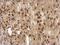 TBC1 Domain Family Member 22A antibody, GTX122604, GeneTex, Immunohistochemistry paraffin image 