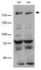 Bromodomain Adjacent To Zinc Finger Domain 1B antibody, M04438, Boster Biological Technology, Western Blot image 