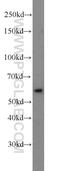 Polo Like Kinase 1 antibody, 19553-1-AP, Proteintech Group, Western Blot image 