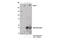 Sodium channel protein type 9 subunit alpha antibody, 14573S, Cell Signaling Technology, Immunoprecipitation image 