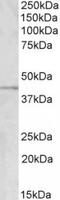 GRAM Domain Containing 2B antibody, TA311196, Origene, Western Blot image 