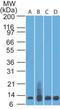 S100 Calcium Binding Protein A8 antibody, NBP2-25269, Novus Biologicals, Western Blot image 