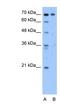 Serine/Threonine Kinase Like Domain Containing 1 antibody, NBP1-55182, Novus Biologicals, Western Blot image 