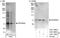 Protein Phosphatase 2 Regulatory Subunit B'Delta antibody, A301-098A, Bethyl Labs, Western Blot image 