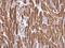 Troponin T2, Cardiac Type antibody, GTX134489, GeneTex, Immunohistochemistry paraffin image 