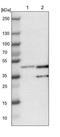 NudE Neurodevelopment Protein 1 Like 1 antibody, NBP1-92206, Novus Biologicals, Western Blot image 