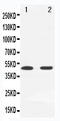 Mitogen-Activated Protein Kinase Kinase 7 antibody, LS-C313057, Lifespan Biosciences, Western Blot image 