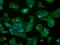 Glutamate-Ammonia Ligase antibody, M03191-1, Boster Biological Technology, Immunofluorescence image 