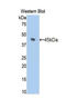 Hexokinase 1 antibody, LS-C299784, Lifespan Biosciences, Western Blot image 