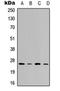 Vesicle Transport Through Interaction With T-SNAREs 1B antibody, orb315742, Biorbyt, Western Blot image 