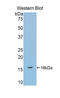 Debranching RNA Lariats 1 antibody, LS-C304794, Lifespan Biosciences, Western Blot image 