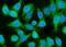 Phosphoinositide-3-Kinase Regulatory Subunit 1 antibody, A00318-1, Boster Biological Technology, Immunofluorescence image 