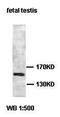 ATP Binding Cassette Subfamily A Member 5 antibody, orb77620, Biorbyt, Western Blot image 