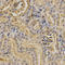 Proteasome 26S Subunit, Non-ATPase 9 antibody, A06113, Boster Biological Technology, Immunohistochemistry paraffin image 