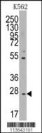 CD8b Molecule antibody, 57-715, ProSci, Western Blot image 