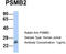 Proteasome Subunit Beta 2 antibody, TA342165, Origene, Western Blot image 