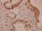 Hes Family BHLH Transcription Factor 6 antibody, A08067, Boster Biological Technology, Immunohistochemistry paraffin image 