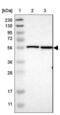 Nuclear Envelope Integral Membrane Protein 1 antibody, NBP1-93649, Novus Biologicals, Western Blot image 