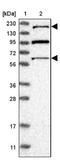 Arginine-Glutamic Acid Dipeptide Repeats antibody, NBP1-88838, Novus Biologicals, Western Blot image 