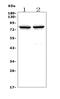 Choline O-Acetyltransferase antibody, A01192-4, Boster Biological Technology, Western Blot image 