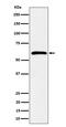 SDC3 antibody, M06245, Boster Biological Technology, Western Blot image 