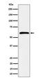 Syndecan 3 antibody, M06245, Boster Biological Technology, Western Blot image 