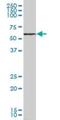 Sphingosine Kinase 2 antibody, H00056848-B01P, Novus Biologicals, Western Blot image 