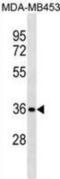 Syntaxin 11 antibody, abx031011, Abbexa, Western Blot image 